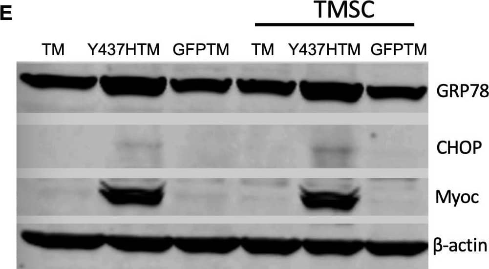 TMSCs could not reverse ER stress and stimulate proliferation of Myoc mutant TM cells in vitro.(A) The TM cells were transduced with recombinant lentivirus encoding GFP and Myoc Y437H mutation. The transduced GFP+ cells were sorted by Flow cytometry and the cultured sorted TM cells were almost 100% with GFP (green) in the cytoplasm. Scale Bars, 100 µm. (B) Transduced TM cells with Myoc Y437H mutation expressed high Myoc by western blotting and TM cells had increased Myoc expression after 5-day Dex treatment (TM2, TM3). TM1 did not have increased Myoc expression after Dex treatment so TM1 cells were discarded. (C) Schematic illustration shows co-culturing of TMSCs with TM cells for detection of TM cell changes. (D) Flow cytometry analysis of EdU incorporation shows neither co-culture nor direct contact with TMSCs for 4 days would affect TM cell proliferation (n=3-5). (E) Representative western blotting bands show the levels of ER stress markers and Myoc in the TM cells with or without TMSC co-culturing. (F) Relative protein levels with b-actin as internal control (n=3). Data are presented as mean ± SD. One-way ANOVA (D) or two-way ANOVA (F) followed by Tukey’s multiple comparisons test.Figure 7—source data 1.Percentage of BrdU positive TM cells in different culture conditions for Figure 7D.Relative protein levels by WB in the TM cells with different culture conditions for Figure 7F.Percentage of BrdU positive TM cells in different culture conditions for Figure 7D.Relative protein levels by WB in the TM cells with different culture conditions for Figure 7F.Structure of lentiviral packaging plasmid: pLentiCMV-Y437H-IRES-GFP. Image collected and cropped by CiteAb from the following open publication (//pubmed.ncbi.nlm.nih.gov/33506763), licensed under a CC-BY license. Not internally tested by R&D Systems.