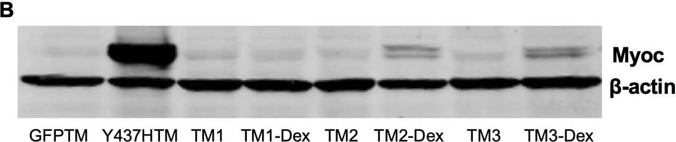 TMSCs could not reverse ER stress and stimulate proliferation of Myoc mutant TM cells in vitro.(A) The TM cells were transduced with recombinant lentivirus encoding GFP and Myoc Y437H mutation. The transduced GFP+ cells were sorted by Flow cytometry and the cultured sorted TM cells were almost 100% with GFP (green) in the cytoplasm. Scale Bars, 100 µm. (B) Transduced TM cells with Myoc Y437H mutation expressed high Myoc by western blotting and TM cells had increased Myoc expression after 5-day Dex treatment (TM2, TM3). TM1 did not have increased Myoc expression after Dex treatment so TM1 cells were discarded. (C) Schematic illustration shows co-culturing of TMSCs with TM cells for detection of TM cell changes. (D) Flow cytometry analysis of EdU incorporation shows neither co-culture nor direct contact with TMSCs for 4 days would affect TM cell proliferation (n=3-5). (E) Representative western blotting bands show the levels of ER stress markers and Myoc in the TM cells with or without TMSC co-culturing. (F) Relative protein levels with b-actin as internal control (n=3). Data are presented as mean ± SD. One-way ANOVA (D) or two-way ANOVA (F) followed by Tukey’s multiple comparisons test.Figure 7—source data 1.Percentage of BrdU positive TM cells in different culture conditions for Figure 7D.Relative protein levels by WB in the TM cells with different culture conditions for Figure 7F.Percentage of BrdU positive TM cells in different culture conditions for Figure 7D.Relative protein levels by WB in the TM cells with different culture conditions for Figure 7F.Structure of lentiviral packaging plasmid: pLentiCMV-Y437H-IRES-GFP. Image collected and cropped by CiteAb from the following open publication (//pubmed.ncbi.nlm.nih.gov/33506763), licensed under a CC-BY license. Not internally tested by R&D Systems.