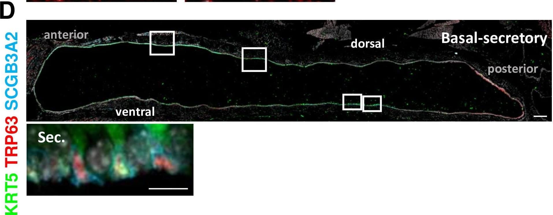 Basal cell (BC) subpopulations other than BC-1 and BC-2 are relatively rare and have no consistent spatial distribution in the adult tracheal epithelium.Representative tile scan pictures of adult mouse tracheal sections immunostained for KRT5, TRP63 and representative markers of Basal-proliferating (A), Basal-squamous (B), Basal-mesenchyme-like (C), and Basal-secretory (D). High magnification images are representative of specific BC subpopulations depicted in boxed areas along the anterior-posterior or dorsal-ventral axis of the tracheal epithelium. Scale bars: large panels of overview: 200 μm; small panels: 10 μm. Image collected and cropped by CiteAb from the following open publication (//pubmed.ncbi.nlm.nih.gov/36178196), licensed under a CC-BY license. Not internally tested by R&D Systems.
