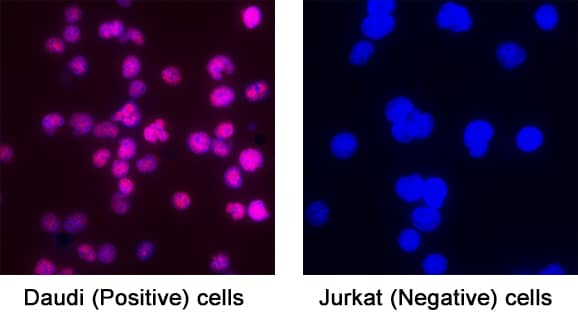 Immunocytochemistry Pax5/BSAP Antibody (1207C) [Unconjugated]