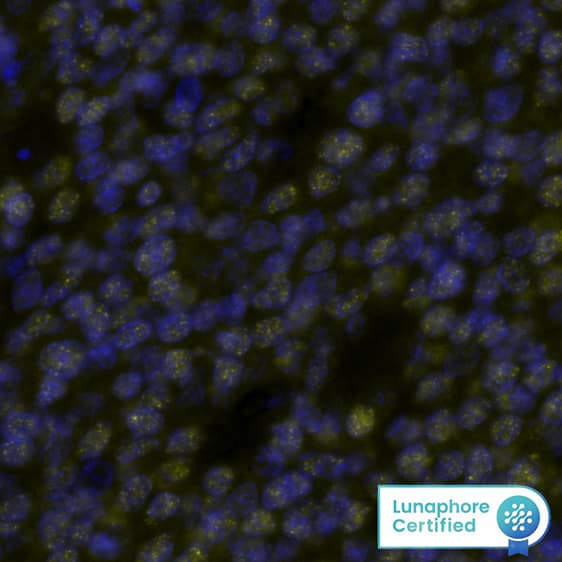 PAX5 Antibody was detected in immersion fixed paraffin-embedded sections of human B-cell Lymphoma using Rabbit Anti-Human PAX5, Monoclonal Antibody (Catalog # MAB9857) at 3ug/mL at 37 ° Celsius for 4 minutes. Before incubation with the primary antibody, tissue underwent an all-in-one dewaxing and antigen retrieval preprocessing using PreTreatment Module (PT Module) and Dewax and HIER Buffer H (pH 9; Epredia Catalog # TA-999-DHBH). Tissue was stained using the Alexa Fluor&amp;#8482; Plus 555 Goat anti-Rabbit IgG Secondary Antibody at 1:100 at 37 ° Celsius for 2 minutes. (Yellow; Lunaphore Catalog # &lt;A class=