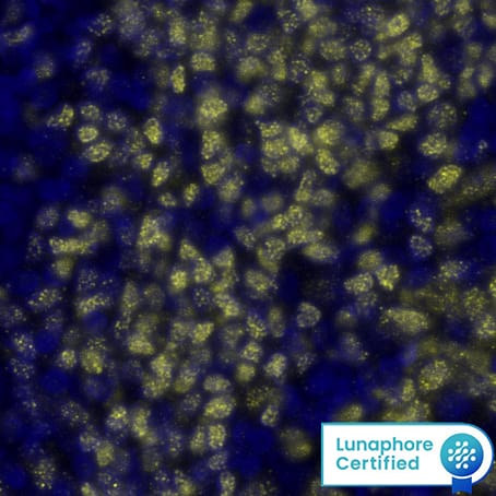 PAX5 Antibody was detected in immersion fixed paraffin-embedded sections of human Tonsil using Rabbit Anti-Human PAX5, Monoclonal Antibody (Catalog # MAB9857) at 5ug/mL at 37 ° Celsius for 4 minutes. Before incubation with the primary antibody, tissue underwent an all-in-one dewaxing and antigen retrieval preprocessing using PreTreatment Module (PT Module) and Dewax and HIER Buffer H (pH 9; Epredia Catalog # TA-999-DHBH). Tissue was stained using the Alexa Fluor&amp;#8482; Plus 555 Goat anti-Rabbit IgG Secondary Antibody at 1:100 at 37 ° Celsius for 2 minutes. (Yellow; Lunaphore Catalog # &lt;A class=