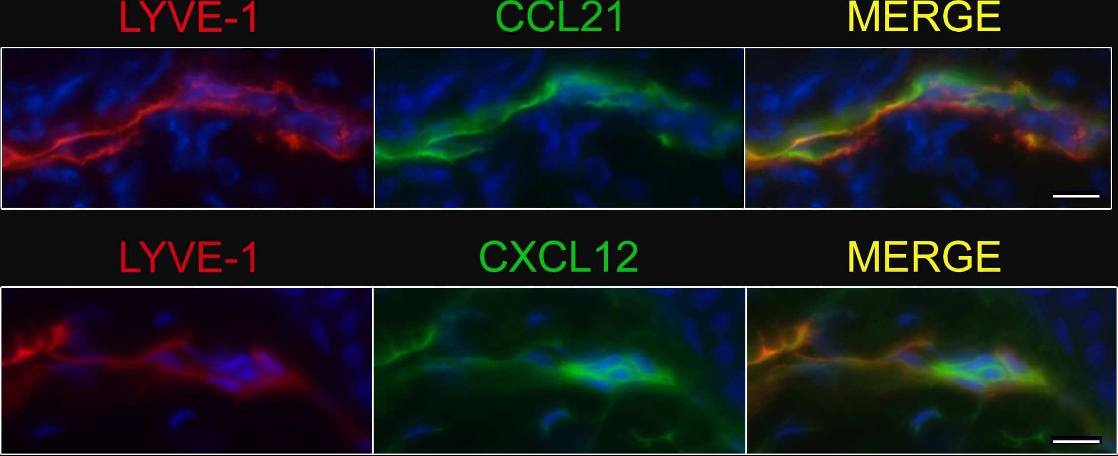 Afferent lymph vessels in chronically inflamed skin express CXCL12.Immunofluorescence staining of frozen sections of chronically inflamed skin (21 days after inflammation elicited by subcutaneous injection of CFA) for CXC12 and CCL21 by LYVE-1+ lymph vessels using DAPI counterstaining. One representative image of lymph vessels analyzed in 5 mice is shown. Scale bars, 10 µm. Image collected and cropped by CiteAb from the following open publication (//pubmed.ncbi.nlm.nih.gov/24752354), licensed under a CC-BY license. Not internally tested by R&D Systems.