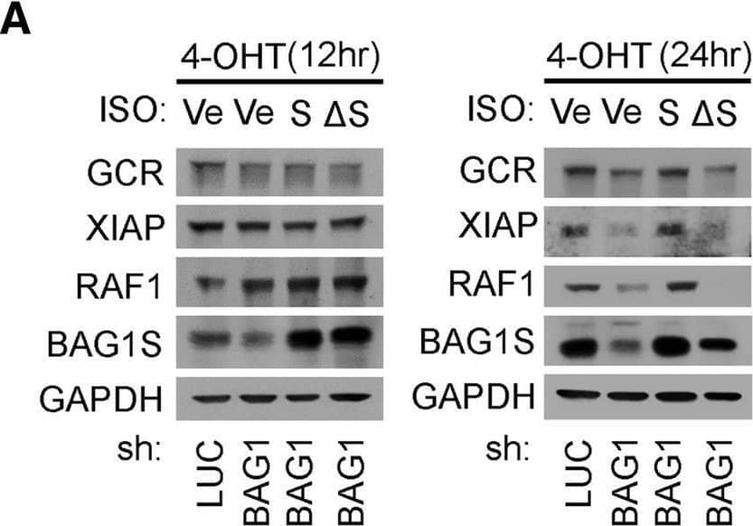 Proteomic analysis identified proteins upregulated in the presence of pro-survival HSP70/BAG1S complex. a U2OS MYC-ER cells expressing ectopic vector, BAG1S, or BAG1 delta S depleted of endogenous BAG1 protein. MYC activity induced for 12 or 24 h with ±100 nM 4-OHT treatment. Lysates analyzed via IB to detect changes in known HSP70 chaperone client proteins GCR, XIAP and RAF1. b Schematic of experimental conditions representing endogenous BAG1 (vector - shLUC), BAG1 knockdown (vector - shBAG1), BAG1S only (BAG1S - shBAG1), or BAG1 delta S only (BAG1 delta S - shBAG1) evaluated for differences in global protein levels. Proteomics analysis outlined with exclusion criteria for significant protein differences between samples. c Efficient knockdown of endogenous BAG1 and rescue of BAG1S and BAG1 delta S shown by IB for samples subjected to proteomics analysis. d Proteomic hits assessed based on schematic of compiled proteins with ≥|1.5| fold change in knockdown compared to control and p ≤ 0.05 across all conditions. Protein expression levels obtained for each sample indexed by specific protein and clustered by UniProt biological process classification. P-values representative of experimental triplicates submitted for proteomic assessment. e Venn diagram showing proteins partially rescued with reintroduction of BAG1S or BAG1 delta S. Increase of ≥10% constitutes a partial rescue. Overlapping proteins with BAG1S or BAG1 delta S indicative of proteins rescued by either ectopic protein. f Verification of proteomics via detection of BAG1S rescued targets SLC7A6 and POLR1D by IB. Image collected and cropped by CiteAb from the following open publication (//pubmed.ncbi.nlm.nih.gov/30902071), licensed under a CC-BY license. Not internally tested by R&D Systems.