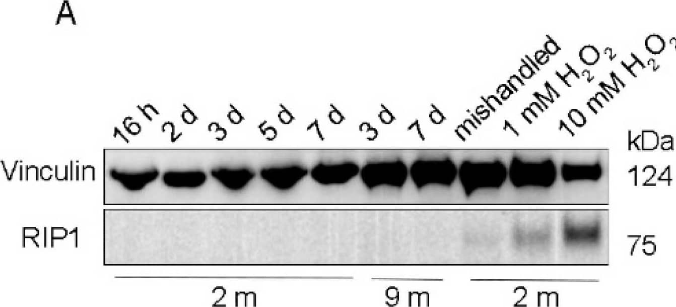 RPE flatmounts are viable for at least one week after culture in vitro. (A) RPE flatmounts were prepared from 2- and 9-month-old wild-type C57BL/6J mice and cultured in complete medium with or without H2O2 for up to one week. Protein lysates were prepared from the RPE flatmounts and subjected to Western blotting analysis. The cell death marker RIP1 was used to evaluate cell viability; vinculin was used as an internal control. As a positive control: RPE flatmounts treated with either 1 mM or 10 mM H2O2 had significant expression of RIP1. Further, the RPE flatmount that was cultured for 7 days without changing the medium (mishandled sample) showed a slight amount of RIP1, whereas the RPE flatmounts cultured with frequent medium changes did not express RIP1, suggesting that the RPE cells obtained even from older mice (9 months) were viable after at least 7 days of culture. (B) RPE flatmounts were obtained from 3-month-old wild-type C57BL/6J mice and cultured in complete medium with or without H2O2 treatment for up to one week. RPE flatmounts were then fixed in 2.5% glutaraldehyde and processed for transmission electron microscopy (TEM). The TEM imaging of the RPE flatmounts cultured for 16 h, 3 days, and 7 days showed that these RPE cells have normal nuclei (yellow arrows) and organelles, such as mitochondria (yellow arrowheads), and abundant microvilli. H2O2-treated RPE flatmounts showed cell death symptoms, including chromatin condensation and fragmentation (red arrow), a disrupted cell membrane, complete loss of microvilli, a translucent cytoplasm, and severely damaged mitochondria (red arrowheads). (C) ZO-1 immunostaining on 2-month-old RPE flatmounts cultured for 3 days showed robust ZO-1 expression, indicating RPE cell integrity. Image collected and cropped by CiteAb from the following open publication (//pubmed.ncbi.nlm.nih.gov/34769409), licensed under a CC-BY license. Not internally tested by R&D Systems.