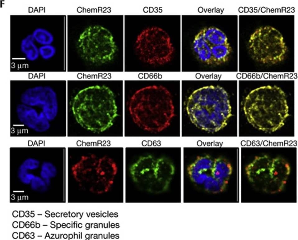 Immunocytochemistry/ Immunofluorescence ChemR23/CMKLR1 Antibody (84939) [Unconjugated]