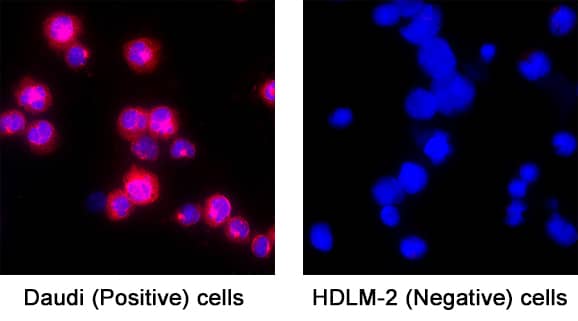 TLR9 was detected in immersion fixed Daudi Human Burkitt's Lymphoma Cell Line (positive) and absent in HDLM‑2 Human Hodgkin’s Lymphoma Cell Line (negative) Cells using Mouse Anti-Human/Mouse TLR9 Monoclonal Antibody (Catalog # MAB36581) at 5 &micro;g/mL for 3 hours at room temperature. Cells were stained using the NorthernLights&trade; 557-conjugated Anti-Mouse IgG Secondary Antibody (red; Catalog # NL007) and counterstained with DAPI (blue). Specific staining was localized to cytoplasm. View our protocol for Fluorescent ICC Staining of Non-adherent Cells.