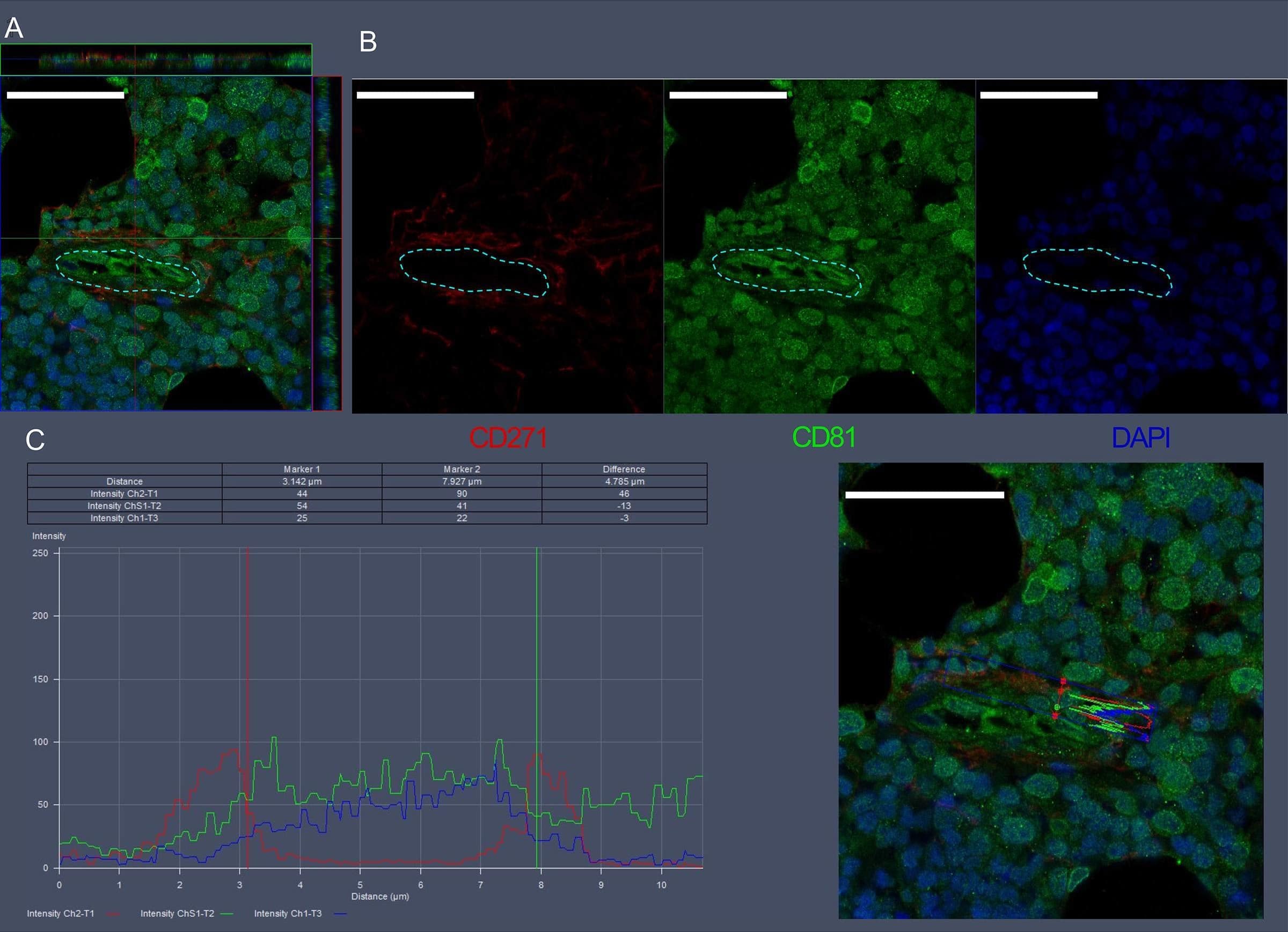 Visualization of CD271 and CD81 expression in bone marrow vascular regions by confocal microscopy.(A) Confocal scan of vascular region in BM biopsies with 3D orthographic cross-section view, co-stained with mouse anti-CD271, rabbit anti-CD81, and DAPI. (B) Single channel data for the florescent markers in A. (C) Intensity profile for all channels in A across a cell of interest in a representative z plane. Scale bars represent 50 μm. Yellow dashed lines indicated vessel surface. Image collected and cropped by CiteAb from the following open publication (//pubmed.ncbi.nlm.nih.gov/36876630), licensed under a CC-BY license. Not internally tested by R&D Systems.