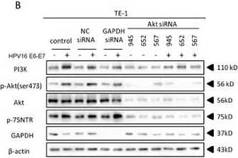 HPV16 E6-E7 increased p75NTR expression through PI3K/Akt signaling pathway in TE-1 cellsA. Proteins involved in PI3K/Akt signaling pathway and p75NTR protein were analysed by western blotting. TE-1 cells were treated by negative control RNA, GAPDH RNA, PI3K siRNA, respectively. Equal protein loading was evaluated by  beta -actin. “-” means HPV16 E6-E7 negative which represents TE-1-control cells, “+” means HPV16 E6-E7 positive which represents TE-1-psb cells. B. Proteins involved in PI3K/Akt signaling pathway and p75NTR protein were analysed by western blotting. TE-1 cells were treated by negative control RNA, GAPDH RNA, Akt siRNA, respectively. Equal protein loading was evaluated by  beta -actin. “-” means HPV16 E6-E7 negative which represents TE-1-control cells, “+” means HPV16 E6-E7 positive which represents TE-1-psb cells. C. Densitometric of western blotting bands in Figure A were analyzed and expressed relative to the loading control,  beta -actin. Data are typical of three experiments and the histogram values are mean ± S.D. *P<0.05,**P<0.01,***P<0.001, relative to control cells in control siRNA group. ###P<0.001, relative to TE-1-psb cell in control siRNA group. D. Densitometric of western blotting bands in Figure B were analyzed and expressed relative to the loading control,  beta -actin. Data are typical of three experiments and the histogram values are mean ± S.D. *P<0.05,**P<0.01,***P<0.001, relative to control cells in control siRNA group or Akt siRNA group. ###P<0.001, relative to TE-1-psb cell in control siRNA group. Image collected and cropped by CiteAb from the following open publication (//pubmed.ncbi.nlm.nih.gov/27489353), licensed under a CC-BY license. Not internally tested by R&D Systems.