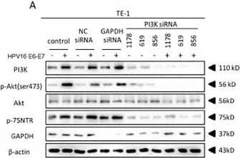 HPV16 E6-E7 increased p75NTR expression through PI3K/Akt signaling pathway in TE-1 cellsA. Proteins involved in PI3K/Akt signaling pathway and p75NTR protein were analysed by western blotting. TE-1 cells were treated by negative control RNA, GAPDH RNA, PI3K siRNA, respectively. Equal protein loading was evaluated by  beta -actin. “-” means HPV16 E6-E7 negative which represents TE-1-control cells, “+” means HPV16 E6-E7 positive which represents TE-1-psb cells. B. Proteins involved in PI3K/Akt signaling pathway and p75NTR protein were analysed by western blotting. TE-1 cells were treated by negative control RNA, GAPDH RNA, Akt siRNA, respectively. Equal protein loading was evaluated by  beta -actin. “-” means HPV16 E6-E7 negative which represents TE-1-control cells, “+” means HPV16 E6-E7 positive which represents TE-1-psb cells. C. Densitometric of western blotting bands in Figure A were analyzed and expressed relative to the loading control,  beta -actin. Data are typical of three experiments and the histogram values are mean ± S.D. *P<0.05,**P<0.01,***P<0.001, relative to control cells in control siRNA group. ###P<0.001, relative to TE-1-psb cell in control siRNA group. D. Densitometric of western blotting bands in Figure B were analyzed and expressed relative to the loading control,  beta -actin. Data are typical of three experiments and the histogram values are mean ± S.D. *P<0.05,**P<0.01,***P<0.001, relative to control cells in control siRNA group or Akt siRNA group. ###P<0.001, relative to TE-1-psb cell in control siRNA group. Image collected and cropped by CiteAb from the following open publication (//pubmed.ncbi.nlm.nih.gov/27489353), licensed under a CC-BY license. Not internally tested by R&D Systems.