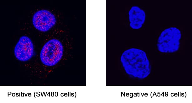 GLI‑3 was detected in immersion fixed  SW480 fibroblast carcinoma cell line (positive staining) and A549 human lung carcinoma cell line (negative staining) using Rabbit Anti-Human GLI‑3 Monoclonal Antibody (Catalog # MAB3690) at 3 &micro;g/mL for 3 hours at room temperature. Cells were stained using the NorthernLights&trade; 557-conjugated Anti-Rabbit IgG Secondary Antibody (red; Catalog # NL004) and counterstained with DAPI (blue). Specific staining was localized to cell nuclei. View our protocol for Fluorescent ICC Staining of Cells on Coverslips.