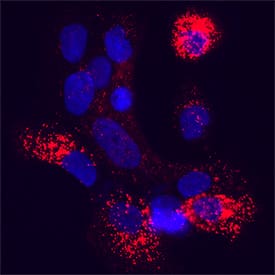 FKBP12 was detected in immersion fixed A431 human epidermoid carcinoma cell line using Mouse Anti-Human FKBP12 Monoclonal Antibody (Catalog # MAB37771) at 3 µg/mL for 3 hours at room temperature. Cells were stained using the NorthernLights™ 557-conjugated Anti-Mouse IgG Secondary Antibody (red; NL007) and counterstained with DAPI (blue). Specific staining was localized to cell cytoplasm. Staining was performed using our protocol for Fluorescent ICC Staining of Adherent Cells.