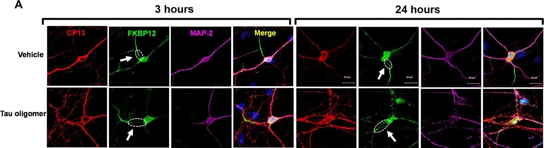 FKBP12 was translocated from axonal hillock to soma and colocalized to oTau.(A) Representative images of tau phosphorylation (CP13 antibody, red) and FKBP12 translocation in primary cortical neurons after induction of tau aggregation by oligomeric S1p fraction. Scale bars, 20 μm. (B) Representative images showed the high expression level of FKBP12 (green) in axonal hillock/axon initial segment (labeled by anti–ankyrin-G antibody, bright blue) under basal conditions whereas FKBP12 translocated to soma and dendrites when neurons bear tau aggregation. Scale bars, 20 μm. (C) Representative images showed the spatial colocalization of FKBP12 and aggregated Tau in the neurons after 24 hours of oTau seeding. Scale bars, 5 μm. DAPI, 4′,6-diamidino-2-phenylindole. (D) Quantification of FKBP12 intensity in the axon hillock of the neurons at 3 and 24 hours of S1p treatment, respectively. Data are expressed as means ± SEM. N = 10. Statistics by two-way ANOVA, post hoc multiple comparisons test by Fisher’s least significant difference (LSD). *P < 0.05, ***P < 0.005, and ****P < 0.001. (E and F) Quantification of granular intensity of CP13-labeled tau aggregates (E) and FKBP12 (F) in neurons at 3 and 24 hours of S1p treatment, respectively. Data are expressed as means ± SEM. N = 10. Statistics by two-way ANOVA, and post hoc multiple comparisons test by Fisher’s LSD. ****P < 0.001. Image collected and cropped by CiteAb from the following open publication (//pubmed.ncbi.nlm.nih.gov/36724228), licensed under a CC-BY license. Not internally tested by R&D Systems.