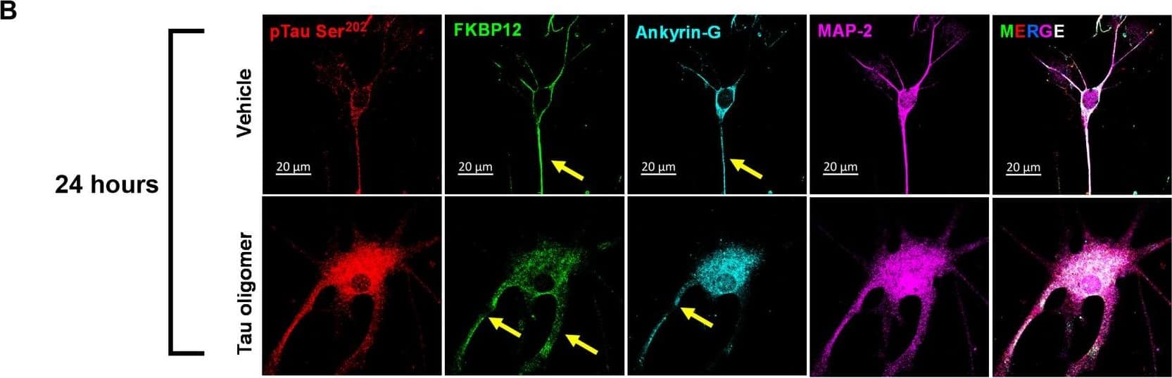 FKBP12 was translocated from axonal hillock to soma and colocalized to oTau.(A) Representative images of tau phosphorylation (CP13 antibody, red) and FKBP12 translocation in primary cortical neurons after induction of tau aggregation by oligomeric S1p fraction. Scale bars, 20 μm. (B) Representative images showed the high expression level of FKBP12 (green) in axonal hillock/axon initial segment (labeled by anti–ankyrin-G antibody, bright blue) under basal conditions whereas FKBP12 translocated to soma and dendrites when neurons bear tau aggregation. Scale bars, 20 μm. (C) Representative images showed the spatial colocalization of FKBP12 and aggregated Tau in the neurons after 24 hours of oTau seeding. Scale bars, 5 μm. DAPI, 4′,6-diamidino-2-phenylindole. (D) Quantification of FKBP12 intensity in the axon hillock of the neurons at 3 and 24 hours of S1p treatment, respectively. Data are expressed as means ± SEM. N = 10. Statistics by two-way ANOVA, post hoc multiple comparisons test by Fisher’s least significant difference (LSD). *P < 0.05, ***P < 0.005, and ****P < 0.001. (E and F) Quantification of granular intensity of CP13-labeled tau aggregates (E) and FKBP12 (F) in neurons at 3 and 24 hours of S1p treatment, respectively. Data are expressed as means ± SEM. N = 10. Statistics by two-way ANOVA, and post hoc multiple comparisons test by Fisher’s LSD. ****P < 0.001. Image collected and cropped by CiteAb from the following open publication (//pubmed.ncbi.nlm.nih.gov/36724228), licensed under a CC-BY license. Not internally tested by R&D Systems.