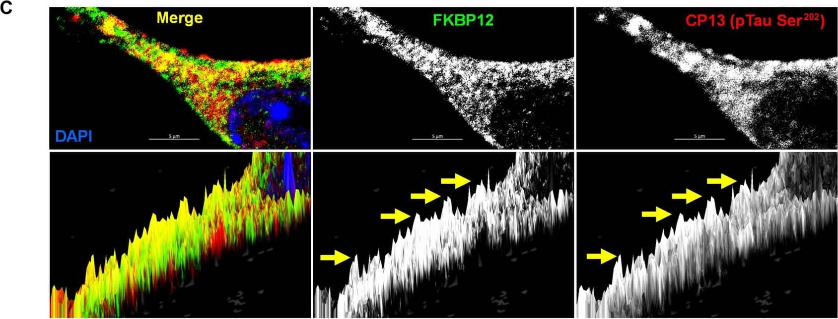 FKBP12 was translocated from axonal hillock to soma and colocalized to oTau.(A) Representative images of tau phosphorylation (CP13 antibody, red) and FKBP12 translocation in primary cortical neurons after induction of tau aggregation by oligomeric S1p fraction. Scale bars, 20 μm. (B) Representative images showed the high expression level of FKBP12 (green) in axonal hillock/axon initial segment (labeled by anti–ankyrin-G antibody, bright blue) under basal conditions whereas FKBP12 translocated to soma and dendrites when neurons bear tau aggregation. Scale bars, 20 μm. (C) Representative images showed the spatial colocalization of FKBP12 and aggregated Tau in the neurons after 24 hours of oTau seeding. Scale bars, 5 μm. DAPI, 4′,6-diamidino-2-phenylindole. (D) Quantification of FKBP12 intensity in the axon hillock of the neurons at 3 and 24 hours of S1p treatment, respectively. Data are expressed as means ± SEM. N = 10. Statistics by two-way ANOVA, post hoc multiple comparisons test by Fisher’s least significant difference (LSD). *P < 0.05, ***P < 0.005, and ****P < 0.001. (E and F) Quantification of granular intensity of CP13-labeled tau aggregates (E) and FKBP12 (F) in neurons at 3 and 24 hours of S1p treatment, respectively. Data are expressed as means ± SEM. N = 10. Statistics by two-way ANOVA, and post hoc multiple comparisons test by Fisher’s LSD. ****P < 0.001. Image collected and cropped by CiteAb from the following open publication (//pubmed.ncbi.nlm.nih.gov/36724228), licensed under a CC-BY license. Not internally tested by R&D Systems.