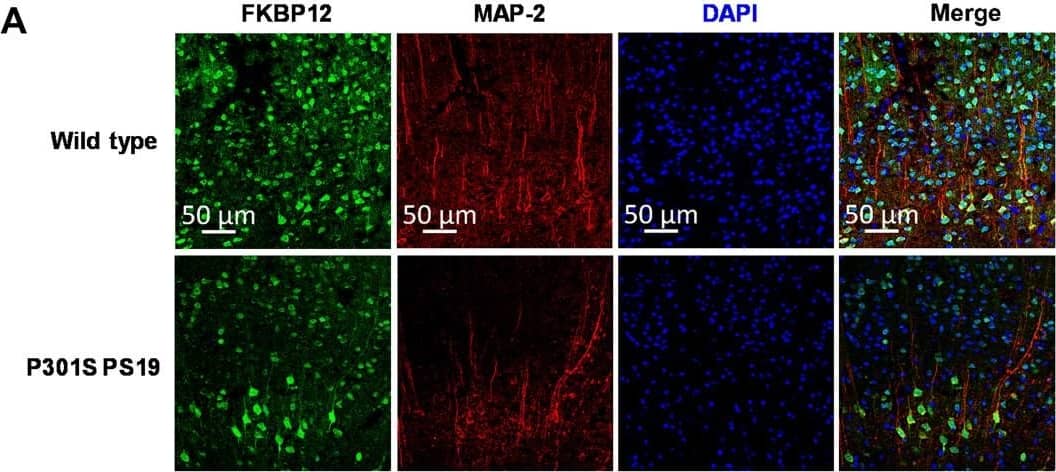 FKBP12 is decreased in PS19 mice brain.(A) Representative images showing the distribution of FKBP12 in entorhinal cortex of mouse brain. Scale bars, 50 μm. (B) Quantification of MAP-2 and FKBP12 fluorescence intensity in entorhinal cortex of PS19 mice brain in comparison to age-matched wild type (WT). Data are expressed as means ± SEM. N = 5. Statistics by unpaired t test, ***P < 0.005. (C) Representative Western blot showing high–molecular weight (HMW) tau aggregation in PS19 mice brain lysate and the decrease of FKBP12 in comparison to wild type. GAPDH, glyceraldehyde-3-phosphate dehydrogenase. (D) Quantification of the tau-5 band intensity showing the robust increase of the ratio between high–molecular weight tau to monomeric tau. (E) Quantification of the FKBP12 band intensity. (F) Representative Western blot images showing the expression level of phosphorylated tau (CP13 and PHF-1), FKBP12, and neuronal markers [postsynaptic density 95 (PSD-95) and MAP-2] in the brain lysate of 3-, 6-, and 9-month-old PS19 mice, respectively. (G) Quantification of the phosphorylated tau (CP13 and PHF-1) band intensity. Result was normalized by internal control of corresponding GAPDH band intensity. (H) Quantification of FKBP12 Western blot (WB) band intensity normalized by GAPDH and MAP-2, respectively. Statistics by one-way analysis of variance (ANOVA), post hoc multiple comparisons test by Tukey’s test. (I) Quantification for the band intensity of neuronal markers including PSD-95 and MAP-2, normalized by GAPDH. Data are expressed as means ± SEM. N = 3. Statistics by two-way ANOVA, and post hoc multiple comparisons test by Tukey’s. **P < 0.01, ***P < 0.005, and ****P < 0.001. Image collected and cropped by CiteAb from the following open publication (//pubmed.ncbi.nlm.nih.gov/36724228), licensed under a CC-BY license. Not internally tested by R&D Systems.