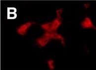 CX3CR1 expressions in affected muscle of patients with polymyositis. The muscle tissues of polymyositis (PM) patients were double-stained with CD4, CD8, or CD68, as well as CX3CR1, and were analyzed with fluorescent microscopy: (A) CX3CR1, (B) CD4, (C) merged (A) and (B), (D) CX3CR1, (E) CD8, (F) merged (D) and (E), (G) CX3CR1, (H) CD68, and (I) merged (G) and (H). Arrows indicate double-positive cells. Original magnification, ×400. Image collected and cropped by CiteAb from the following open publication (//pubmed.ncbi.nlm.nih.gov/22394569), licensed under a CC-BY license. Not internally tested by R&D Systems.