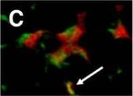 CX3CR1 expressions in affected muscle of patients with polymyositis. The muscle tissues of polymyositis (PM) patients were double-stained with CD4, CD8, or CD68, as well as CX3CR1, and were analyzed with fluorescent microscopy: (A) CX3CR1, (B) CD4, (C) merged (A) and (B), (D) CX3CR1, (E) CD8, (F) merged (D) and (E), (G) CX3CR1, (H) CD68, and (I) merged (G) and (H). Arrows indicate double-positive cells. Original magnification, ×400. Image collected and cropped by CiteAb from the following open publication (//pubmed.ncbi.nlm.nih.gov/22394569), licensed under a CC-BY license. Not internally tested by R&D Systems.