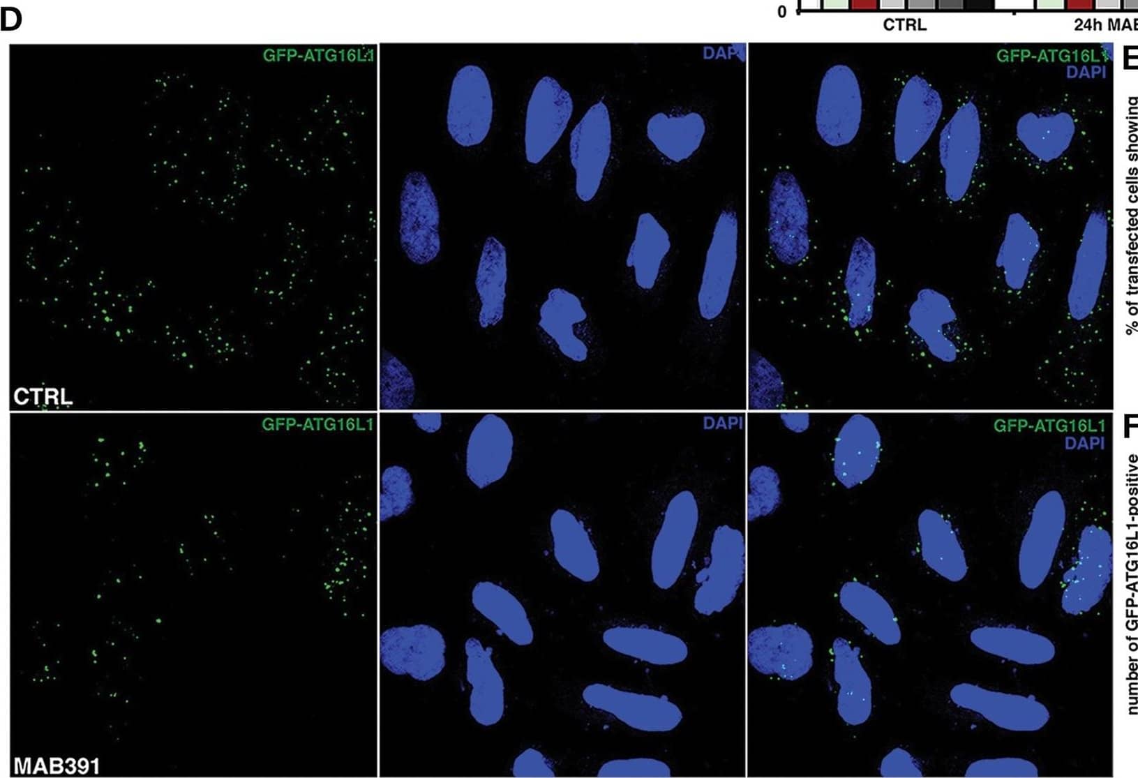 IGF1-R inhibition decreases autophagosome precursor formation by reducing clathrin-dependent endocytosis. (D–F) HeLa cells were transfected with 0.5 μg of the GFP-Atg16L1 construct. After 24 h, the cells were treated for 24 h with MAB391, fixed&analysed under fluorescence microscope. The P-values for assessing the %age of cells showing ≥20 GFP-Atg16-positive vesicles as well as the number of GFP-Atg16 vesicles/cell determined by Student's t-test (E: n = 3; CTRL versus 24 h MAB391, P = 0.00272; F: n = 3; CTRL versus 24 h MAB391, P = 0.00496). Image collected & cropped by CiteAb from the following open publication (//pubmed.ncbi.nlm.nih.gov/23804751), licensed under a CC-BY license. Not internally tested by R&D Systems.