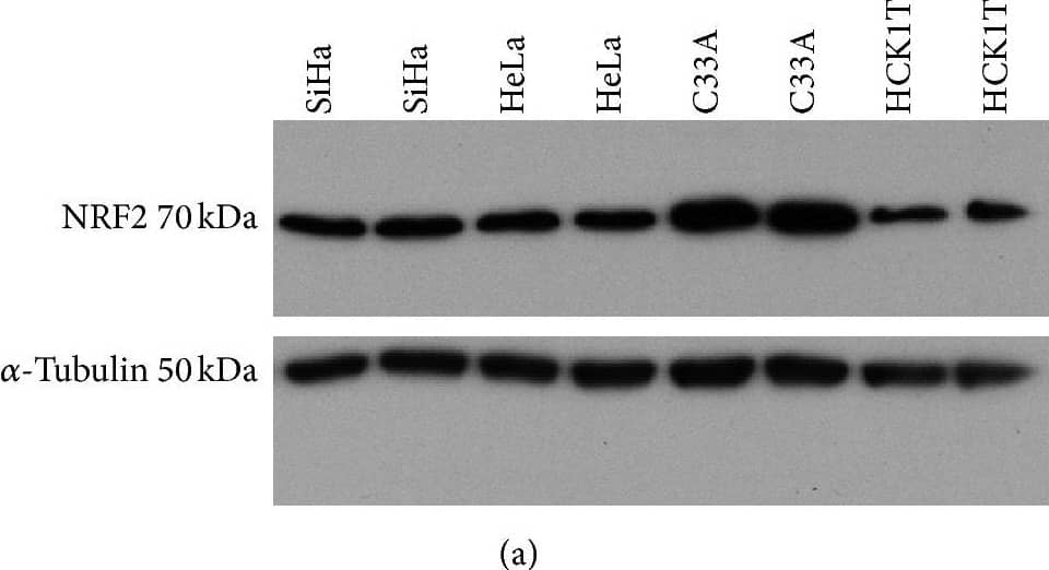 Confirmation of the IPA-predicted NRF2 activation in cancer cell lines by Western blot. Western blot analysis with NRF2-specific antibody in four different cell extracts per cell line (SiHa, HeLa, C33A, and HCK1T), corresponding to four biological replicates. Twenty μg was loaded. (a) A protein band of 70 kDa corresponding to NRF2 is detected. Immunoblotting for  alpha -tubulin (50 kDa) was applied to ensure the comparable loading of proteins in each lane. Fold expression of NRF2 was assessed relative to HCK1T. (b) The mean NRF2 values for SiHa, HeLa, and C33A were 1.4 ± 0.1 (p  0.05), and 2.3 ± 0.3 (p < 0.05) compared to HCK1T, respectively. Representative images of two biological replicates are shown for each cell line. Graphical representation of densitometry analysis of the results (mean ± SD) is also shown (∗p < 0.05, Student's t-test). Image collected and cropped by CiteAb from the following publication (//pubmed.ncbi.nlm.nih.gov/28261610), licensed under a CC-BY license. Not internally tested by R&D Systems.