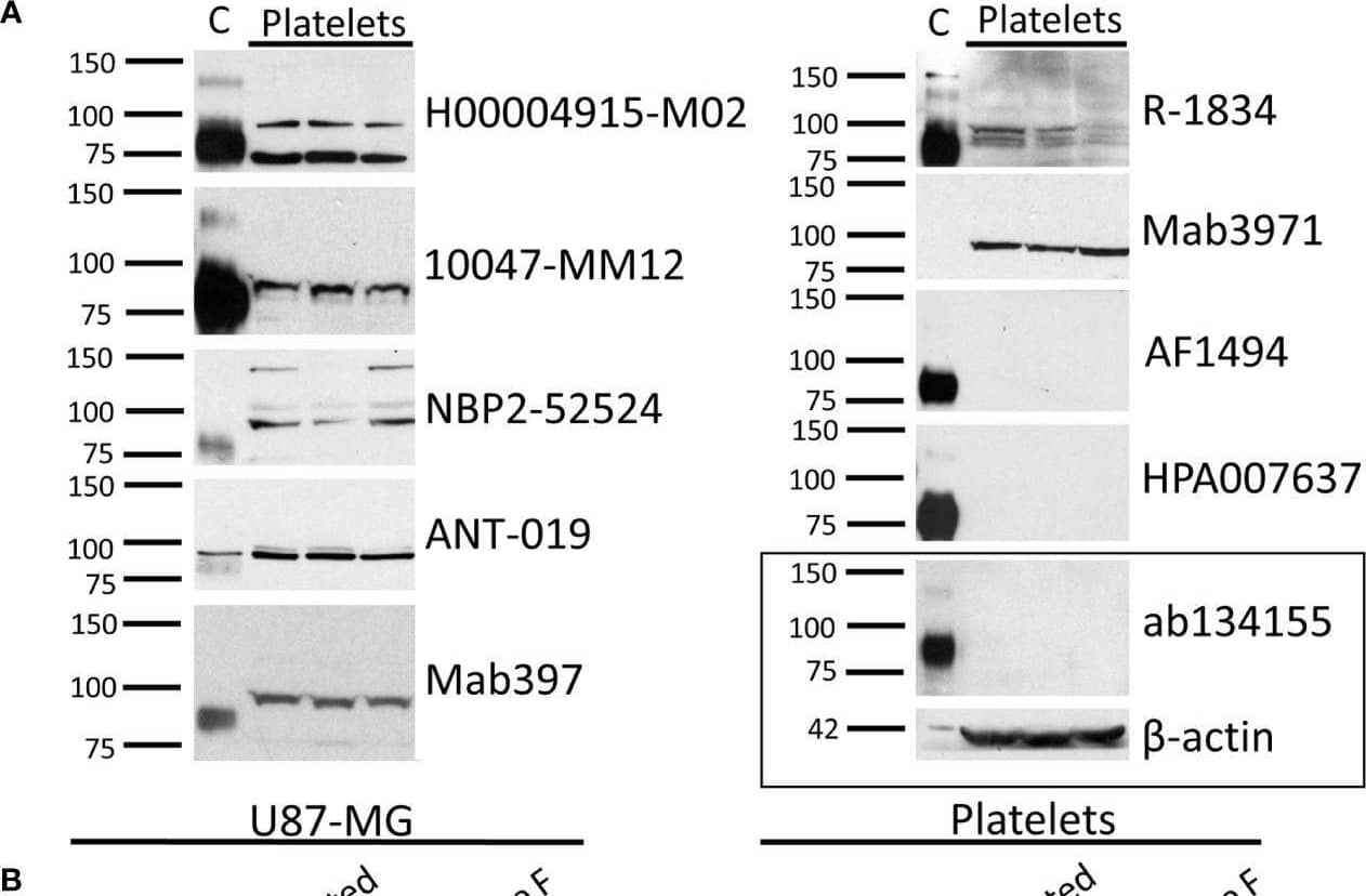 Western Blot TrkB Antibody (72509) [Unconjugated]