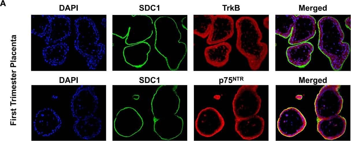 Expression of BDNF receptors in human placental tissues. (A) Representative confocal immunofluorescence staining images of showing DAPI (blue) and SDC1 (a syncytiotrophoblast biomarker, green) along with TrkB (red) and p75NTR (red) receptors in the first trimester placenta. (B) Confocal immunofluorescence staining images showing DAPI, SDC1, TrkB, and p75NTR in the term placenta. Image collected and cropped by CiteAb from the following open publication (//pubmed.ncbi.nlm.nih.gov/34394001), licensed under a CC-BY license. Not internally tested by R&D Systems.