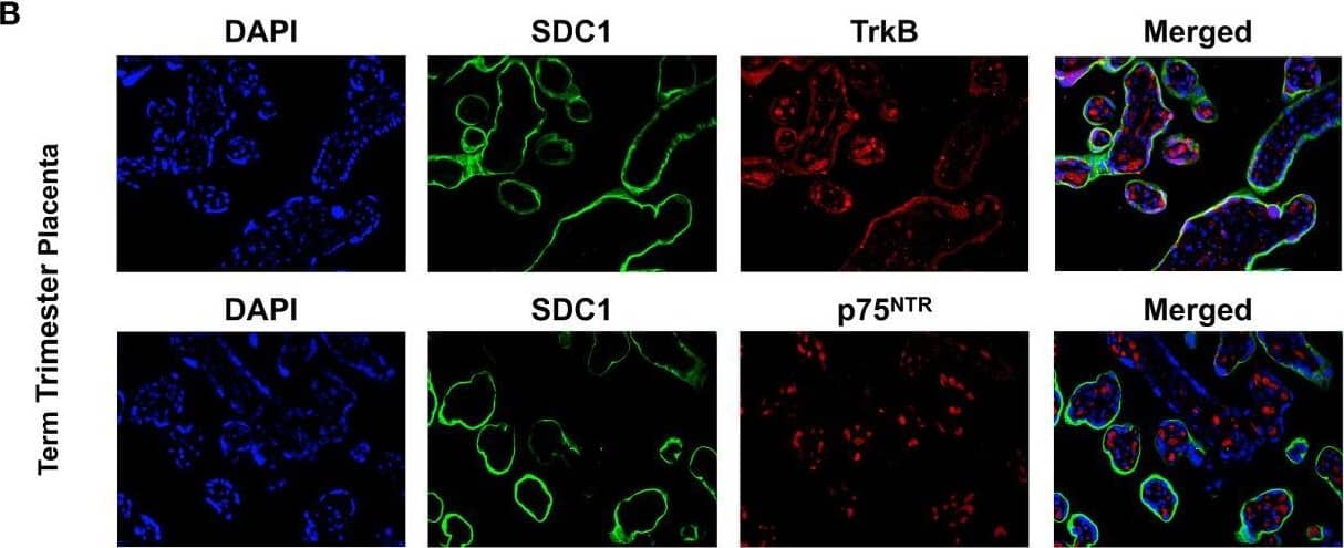 Expression of BDNF receptors in human placental tissues. (A) Representative confocal immunofluorescence staining images of showing DAPI (blue) and SDC1 (a syncytiotrophoblast biomarker, green) along with TrkB (red) and p75NTR (red) receptors in the first trimester placenta. (B) Confocal immunofluorescence staining images showing DAPI, SDC1, TrkB, and p75NTR in the term placenta. Image collected and cropped by CiteAb from the following open publication (//pubmed.ncbi.nlm.nih.gov/34394001), licensed under a CC-BY license. Not internally tested by R&D Systems.