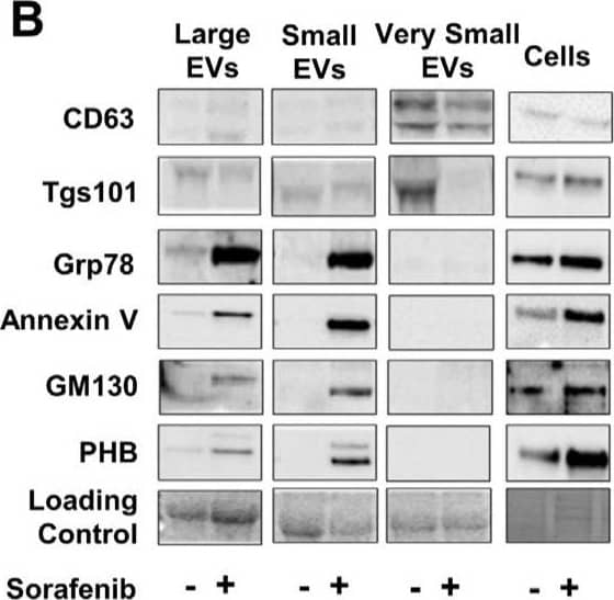 Extracellular vesicle secretion induced by Sorafenib and their miRNA content. (A) Particle size and concentration analysis of Large, Small, and Very Small EVs obtained at 6 and 24 h. (B) Expression of EV markers and cellular contaminants in Large, Small, and Very Small EVs and cell lysates obtained at 24 h after Sorafenib treatment. Total lane protein content was used as the loading control. (C) Representative images of cryo-EM of Small and Very Small EVs obtained at 6 and 24 h from the control and Sorafenib-treated cells. (D) Assessment of EV size (nm) in the cryo-EM images. (E) Number of EVs quantified in the cryo-EM images. (F) miRNA expression in the three fractions of EVs at 6 h. (G) miRNA expression in the three fractions of EVs at 24 h. Fold-change values were calculated between Sorafenib and the control treated samples. Results are expressed as the mean ± SEM of six independent experiments. Ns, non-significant; * p ≤0.05, ** p ≤ 0.01, *** p ≤ 0.001, and **** p ≤ 0.0001 between the miRNA expression in the control and Sorafenib derived EVs. Multiple comparison test statistics are expressed with lower case a–i. Image collected and cropped by CiteAb from the following open publication (//pubmed.ncbi.nlm.nih.gov/36078082), licensed under a CC-BY license. Not internally tested by R&D Systems.