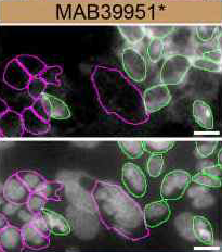 <b>Genetic Strategies Validation. </b>HEK293T human embryonic kidney parental cell line WT and Park7/DJ‑1 HEK293T KO cells were labelled with a green or a far-red fluorescent dye, respectively. Cells were stained with Mouse Anti-Human/Mouse/Rat Park7/DJ‑1 Monoclonal Antibody (Catalog # MAB39951) followed by incubation with an Alexa-fluor 555 conjugated secondary antibody (upper panel). DAPI-only counterstained cells shown on a lower panel. Acquisition of the blue (nucleus-DAPI), green (identification of WT cells), red (antibody staining) and far-red (identification of KO cells) channels was performed. Representative images of the blue and red (grayscale) channels are shown. WT and KO cells are outlined with green and magenta dashed line, respectively. Primary antibody dilution used: 1 µg/mL. Image, protocol and testing courtesy of YCharOS Inc. (ycharos.com).