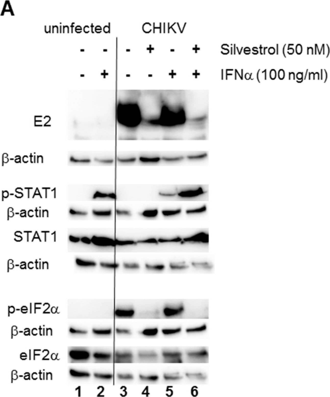Analysis of signal transduction during CHIKV infection in the presence of 50 nM silvestrol. (A) HEK 293T cells were seeded in six-well plates and were infected with CHIKV using an MOI of 1, and 50 nM silvestrol was added where indicated. Cells were treated with IFN alpha  for 30 min before harvest if indicated, and Western blot analysis of cell lysates was performed. (−) Untreated cells; (+) treated cells. In lanes 3–6, cells were infected with CHIKV. The CHIKV E2 protein, STAT1, eIF2 alpha , and their phosphorylated proteins were detected with specific antibodies and secondary HRP-coupled antibodies, and the ECL detection system (Amersham, Freiburg). Equal loading of each blot was controlled by detection of  beta -actin; and, (B) Uninfected HEK293T cells were treated with IFN alpha  for 30 min before harvest and either treated with silvestrol for 16 h or left untreated. Western blot analysis of cell lysates was performed and p-STAT1 and STAT1 were detected. STAT1 served as a loading control. Image collected and cropped by CiteAb from the following open publication (//pubmed.ncbi.nlm.nih.gov/30380742), licensed under a CC-BY license. Not internally tested by R&D Systems.