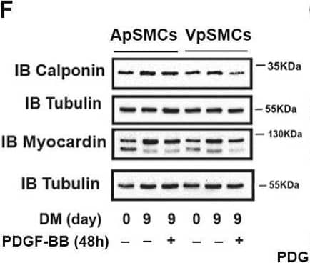 Differences in cell behavior between pig arterial smooth muscle cells (ApSMCs) and venous smooth muscle cells (VpSMCs). (A) The purity of VSMCs was demonstrated with anti-smooth muscle actin immunofluorescent staining, following the protocol described in the Materials and Methods. Scale bars = 200 microns. (B,C) Cell proliferation under the growth medium (GM) or in response to PDGF-BB stimulation was measured following the protocol described in the Materials and Methods. Different letters (a, b) indicated significant difference between two groups. (D) Cell migration assays were performed via scratch assays in serum-free (SF) or 10% FBS containing GM. (E) Migrated cells in scratched areas were counted. Scale bars = 200 microns. (F) Cells were induced to differentiate with a differentiation medium (DM), and 48 h before collecting cell lysates, PDGF-BB was applied in the indicated wells. (G,H) The densitometry of each band was obtained using Image J (NIH version 1.53K), and ratio values were obtained by interested protein bands/loading control bands. (n = 6 for calponin; n = 5 for myocardin.) ****: p < 0.000; ***: p < 0.001; **: p < 0.01; *: p < 0.05; ns: no significant differences were found using a Student’s t-test for two-group comparisons and an ANOVA test for multiple group comparisons. Image collected and cropped by CiteAb from the following open publication (//pubmed.ncbi.nlm.nih.gov/40243809), licensed under a CC-BY license. Not internally tested by R&D Systems.