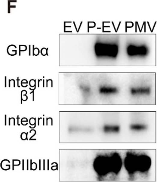 Membrane fusion study and protein markers characterization. (A) Fluorescence intensity of P-EVs in the FRET study and quantification of FRET efficiency after membrane fusion at different ratio. PMVs labeled with a pair of FRET fluorescent dyes were fused with increasing amounts of EVs. A recovery of fluorescence at 534 nm indicated the fusion of PMVs and EVs (PMV:EV = the protein ratio of platelet membrane to EV). (B) Structured illumination microscopic imaging of either P-EVs or a mixture of PMVs and EVs without extrusion (green: PMV, red: EV). Scale bar = 5 µm. (C) Immunogold TEM images of PMVs, EVs and P-EVs probe for CD90 (green arrows, small gold nanoparticles) and GPIb alpha  (red arrow, large gold nanoparticles). Scale bar = 100 nm. (D) Protein contents of EVs, P-EVs and PMVs on a Coomassie blue stained SDS-PAGE gel. (E) Western blot analysis of Alix, TSG101, CD9 and CD90 expression in EVs, P-EVs and PMVs. (F) Western blot analysis of GP Ib alpha , integrin  alpha 2/ beta 1 and GPIIbIIIa expression in EVs, P-EVs and PMVs. All samples were run at equivalent protein concentrations. Image collected and cropped by CiteAb from the following open publication (//pubmed.ncbi.nlm.nih.gov/33664870), licensed under a CC-BY license. Not internally tested by R&D Systems.