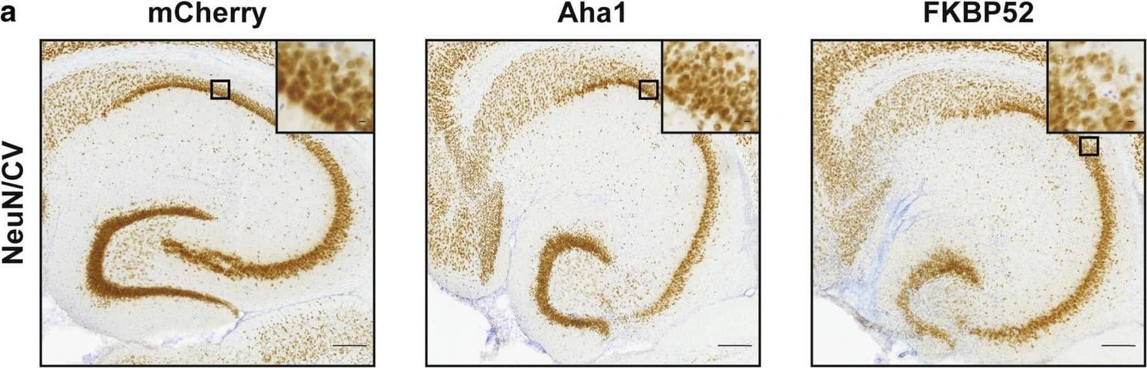 Overexpression of FKBP52 promotes neurotoxicity in aged wild-type mice. (a) Representative images from hippocampal neurons stained with NeuN (brown) and cresyl violet (purple). These hippocampal slices correspond to AAV9-mCherry, AAV9-Aha1, and AAV9-FKBP52 injected wild-type mice. Quantification of CA1 hippocampal (b) neuronal density and (c) volume using unbiased stereology from these animals. N = 6/AAV. Results represent the standard error of the mean (± SEM). Data was analyzed by a one-way ANOVA followed by Tukey post-hoc test. *p < 0.05 and **p < 0.01 is considered statistical difference in neuronal loss. Scale bars = 100 µm and inset scale represents 10 µm. CV, cresyl violet; CA1, Cornu ammonis subfield 1; HPC, hippocampus Image collected and cropped by CiteAb from the following open publication (//pubmed.ncbi.nlm.nih.gov/33832539), licensed under a CC-BY license. Not internally tested by R&D Systems.