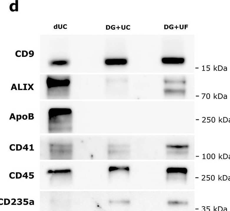 Density gradient ultracentrifugation combined with size exclusion chromatography and ultrafiltration recovers high particle numbers and reduces co-isolates. (a) A set of three peripheral blood samples was each collected in n=3 biological replicates in Streck Cell-Free DNA BCT. EVs were isolated using either differential ultracentrifugation (dUC) or density gradient ultracentrifugation (DG), followed by SEC. Following SEC, DG-purified EVs were concentrated either by ultracentrifugation (DG+UC) or by ultrafiltration (DG+UF). EV-enriched fractions were analyzed by nanoparticle tracking analysis (NTA) and western blot (WB). (b) Total particle recovery and (c) median particle size measured by NTA in EV-enriched fractions using different combinations of purification methods. In (b) and (c) mean values are displayed for each processing condition, and in (b) statistical significance is assessed using paired t test (DG+UC vs. DG+UF) with *p=0.0311. In (b) and (c) symbols signify independent biological replicates. (d) Representative immunoblotting of EV-enriched fractions obtained with the different strategies. Original blots are presented in Supplementary Fig. S11 online. Image collected and cropped by CiteAb from the following open publication (//pubmed.ncbi.nlm.nih.gov/40624148), licensed under a CC-BY license. Not internally tested by R&D Systems.