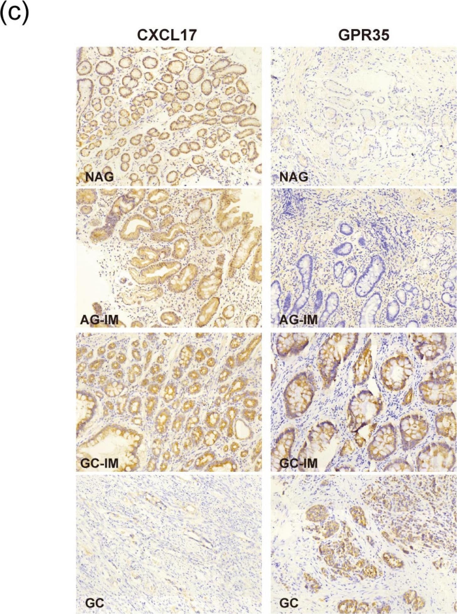 The protein expression of CXCL17 (a) and GPR35 (b) in different pathological lesions determined by immunohistochemistry. ** p < 0.01, *** p < 0.001. (c) Representative immunostaining images of CXCL17 and GPR35 in different gastric pathological lesions. Magnification: ×200. ns, no significance; NAG-NOR, normal gastric gland of non-atrophic gastritis; AG-IM, intestinal metaplasia of atrophic gastritis, GC-IM, intestinal metaplasia adjacent to gastric cancer; GC, gastric cancer. Image collected and cropped by CiteAb from the following open publication (//pubmed.ncbi.nlm.nih.gov/36614059), licensed under a CC-BY license. Not internally tested by R&D Systems.