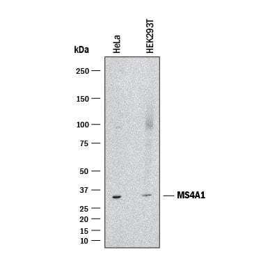Western blot shows lysates of HeLa human cervical epithelial carcinoma cell line and HEK293T human embryonic kidney cell line. PVDF membrane was probed with 2 µg/mL of Mouse Anti-Human CD20 Monoclonal Antibody (Catalog # MAB42251) followed by HRP-conjugated Anti-Mouse IgG Secondary Antibody (HAF018). A specific band was detected for CD20 at approximately 33 kDa (as indicated). This experiment was conducted under reducing conditions and using Western Blot Buffer Group 1.