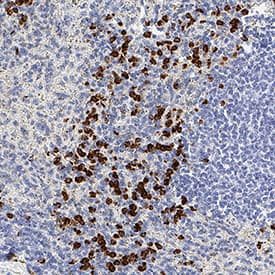 CEACAM‑8/CD66b was detected in immersion fixed paraffin-embedded sections of human spleen using Mouse Anti-Human CEACAM‑8/CD66b Monoclonal Antibody (Catalog # MAB4246) at 0.5 µg/ml for 1 hour at room temperature followed by incubation with the Anti-Mouse IgG VisUCyte™ HRP Polymer Antibody (Catalog # VC001). Before incubation with the primary antibody, tissue was subjected to heat-induced epitope retrieval using VisUCyte Antigen Retrieval Reagent-Basic (Catalog # VCTS021). Tissue was stained using DAB (brown) and counterstained with hematoxylin (blue). Specific staining was localized to the cell surface. View our protocol for IHC Staining with VisUCyte HRP Polymer Detection Reagents.