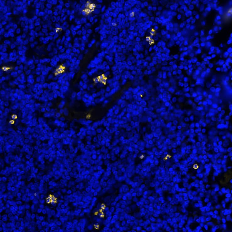 CEACAM-8 was detected in immersion fixed paraffin-embedded sections of human tonsil using Mouse Anti-Human CEACAM-8, Monoclonal Antibody (Catalog #MAB4246) at 1ug/mL at 37° Celsius for 4 minutes. Before incubation with the primary antibody, tissue underwent an all-in-one dewaxing and antigen retrieval preprocessing using PreTreatment Module (PT Module) and Dewax and HIER Buffer H (pH 9; Epredia Catalog #TA-999-DHBH). Tissue was stained using the Alexa Fluor™ 647 Goat anti-Mouse IgG Secondary Antibody at 1:200 at 37 ° Celsius for 2 minutes. (Yellow; Lunaphore Catalog # DR647MS) and counterstained with DAPI (blue; Lunaphore Catalog # DR100). Specific staining was localized to the membrane. Protocol available in COMET™ Panel Builder.