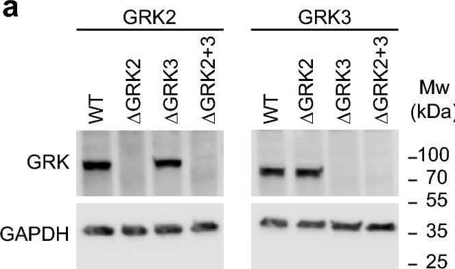 Western Blot GRK2 Antibody (2089B) [Unconjugated]