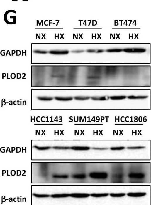Chronic hypoxia affects metabolism in luminal breast cancer cells. A, B Heatmap of genes involved in glycolysis (A) and cytoskeleton (B) pathways in 24 h (acute) and 5 days (chronic) hypoxia in MCF-7 and HCC1143 cells. NA, not available; ****padj < 0.0001; ***padj < 0.001; **padj < 0.01; *padj < 0.05; ns, not significant. White color means that genes were filtered out in targeted RNA sequencing data after filtering by DESeq2 package in R software. C Lactate levels (mM) in 6 cell lines under normoxia normalized to the OD value determined in SRB assay. D, E Lactate levels measured in three luminal (MCF-7, T47D, BT474) (D) and 3 basal A (HCC1143, SUM149PT, HCC1806) (E) breast cancer cell lines under acute normoxia/ hypoxia and chronic normoxia/ hypoxia normalized to the OD value determined in SRB assay. F CA9 RNA expression level under hypoxia in luminal and basal A cell lines detected by qRT-PCR. Log2(2^(-delta  delta CT)) was calculated by normalizing to normoxia in each cell line. Error bars indicate SD for triplicate measurements. ***p < 0.001; **p < 0.01; *p < 0.05. G GAPDH and PLOD2 protein expression detected by Western blot. B-actin serves as loading control. H Quantification of GADPH signal normalized to B-actin with Image J. Error bars indicate SD for triplicate measurements. **p < 0.01; *p < 0.05; ns, not significant Image collected and cropped by CiteAb from the following open publication (//pubmed.ncbi.nlm.nih.gov/36826702), licensed under a CC-BY license. Not internally tested by R&D Systems.