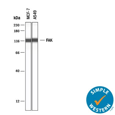 Simple Western lane view shows lysates of MCF‑7 human breast cancer cell line and A549 human lung carcinoma cell line, loaded at 0.2 mg/mL. A specific band was detected for FAK at approximately 120 kDa (as indicated) using 20 µg/mL of Mouse Anti-Human FAK Monoclonal Antibody (Catalog # MAB4467) . This experiment was conducted under reducing conditions and using the 12-230 kDa separation system.