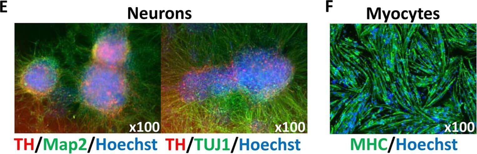 Generation of DM1-iPSCs and their differentiation.(A) The strategy of our study: patient iPSCs were passed and differentiated at three different passage numbers into CMs or neurons giving 9 samples (left), or had a MyoD1 vector transfected and were differentiated into myocytes, giving 6 samples (right). The CTG repeat lengths were measured in each sample. (B) Six clones from three different DM1 patients expressed pluripotent stem cell markers (Oct3/4, Nanog and Sox2) in conventional PCR.  beta -actin was used as a loading control. (C) Karyotypic analysis of undifferentiated iPSCS (Pt-1B). (D, left) Representative live image of CMs on day 20 (Pt-1B). A video clip is available in Supplementary Video 1. (D, right) FACS analysis of the CMs shown in the picture on the left. The X-axis indicates the percentage of cardiac troponin T (cTnT)-positive cells among the total number of CMs. The Y-axis indicates the autofluorescence of the CMs. (E) Representative immunostaining image of neurons on day 42 (Pt-1B). The left panel shows neurons that expressed Tyrosine Hydroxylase (TH) and Microtubule-associated protein 2 (Map2). The right panel shows neurons that expressed TH and Neuron-specific Class III  beta -tubulin (TUJ1). (F) Representative immunostaining image of myocytes on day 7 (Pt-1B). The myocytes expressed Myosin Heavy Chain (MHC). Hoechst stains the nuclei. Image collected and cropped by CiteAb from the following publication (//pubmed.ncbi.nlm.nih.gov/28211918), licensed under a CC-BY license. Not internally tested by R&D Systems.