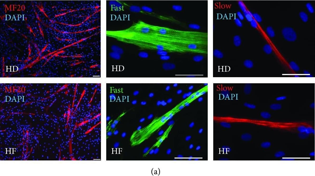 Differentiated myotubes do not differ significantly between HD- and HF-derived skeletal muscle progenitor cells. (a) At day 7 after stimulation, myotubes were stained for the expression of MyHC with an antibody that recognizes the heavy chain of myosin II (MF20) and markers of slow MYH7 and fast MYH1/MYH2 fibers. Nuclei were labelled with DAPI (blue). Representative images are given for both HF- and HD-derived samples. Scale bars represent 50 μm. (b) Fusion coefficient is calculated as a percent of nuclei incorporated in MF20+ myotubes at day 7 after stimulation, and it does not differ between HD- and HF-derived samples. (c) mRNA expression analysis was performed for key markers of muscle development and metabolism for both HF- and HD-derived samples. Image collected and cropped by CiteAb from the following publication (//pubmed.ncbi.nlm.nih.gov/30719048), licensed under a CC-BY license. Not internally tested by R&D Systems.