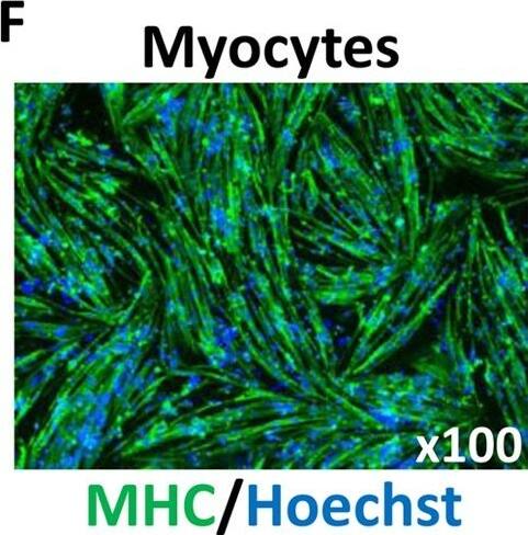 Generation of DM1-iPSCs and their differentiation.(A) The strategy of our study: patient iPSCs were passed and differentiated at three different passage numbers into CMs or neurons giving 9 samples (left), or had a MyoD1 vector transfected and were differentiated into myocytes, giving 6 samples (right). The CTG repeat lengths were measured in each sample. (B) Six clones from three different DM1 patients expressed pluripotent stem cell markers (Oct3/4, Nanog and Sox2) in conventional PCR.  beta -actin was used as a loading control. (C) Karyotypic analysis of undifferentiated iPSCS (Pt-1B). (D, left) Representative live image of CMs on day 20 (Pt-1B). A video clip is available in Supplementary Video 1. (D, right) FACS analysis of the CMs shown in the picture on the left. The X-axis indicates the percentage of cardiac troponin T (cTnT)-positive cells among the total number of CMs. The Y-axis indicates the autofluorescence of the CMs. (E) Representative immunostaining image of neurons on day 42 (Pt-1B). The left panel shows neurons that expressed Tyrosine Hydroxylase (TH) and Microtubule-associated protein 2 (Map2). The right panel shows neurons that expressed TH and Neuron-specific Class III  beta -tubulin (TUJ1). (F) Representative immunostaining image of myocytes on day 7 (Pt-1B). The myocytes expressed Myosin Heavy Chain (MHC). Hoechst stains the nuclei. Image collected and cropped by CiteAb from the following publication (//www.nature.com/articles/srep42522), licensed under a CC-BY license. Not internally tested by R&D Systems.