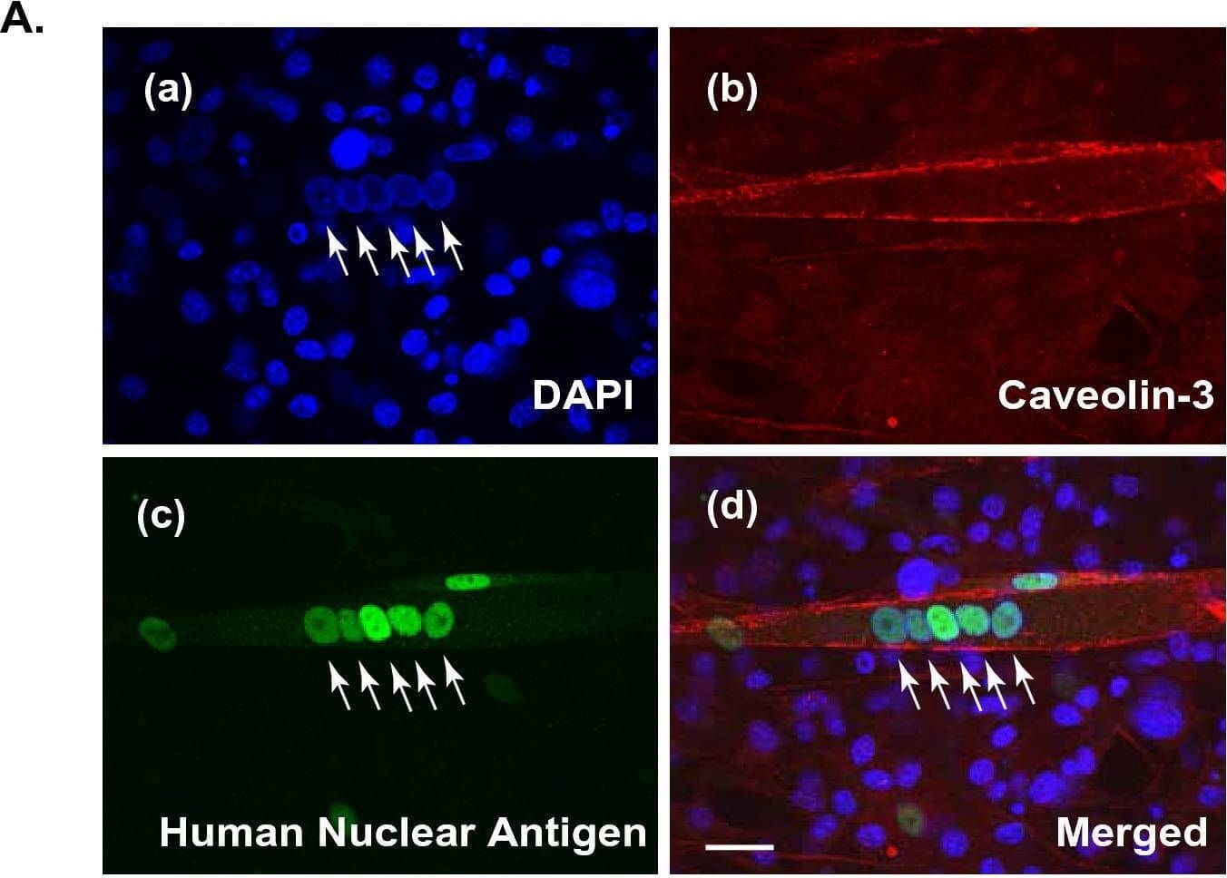 Sarcomere formation in contracting human myotubes on mouse fibroblast feeders. (A) After 7–8 days of differentiation, the differentiated human myotubes (derived from HSMM) on the feeder layers of mouse 3T3L1 fibroblasts were fixed and then observed for myotubular formation by using anti-human nuclear antigen (anti-HNA) and anti-Caveolin 3 antibodies, as described in the “Methods” section. DAPI was used for nuclear staining. Scale bar = 25 μm. Three independent experiments were performed, and representative images are presented. (B) The differentiated human myotubes on the mouse fibroblast feeders were subjected to either no (panels a and b) EPS or (panels c and d) EPS treatment (1 Hz frequency, 4-ms duration, 20 V/25 mm for a total 24 h of with intermittent intervals) and then fixed for evaluating sarcomere formation status by using anti-sarcomeric-alpha -actinin (green) and anti-Caveolin 3 (red) antibodies. DAPI was used for nuclear staining (blue). Scale bar = 25 μm. Magnified images (panels b and d) of the white boxes in panels a and c, respectively, are also presented. Three independent experiments were performed and representative images are presented. Image collected and cropped by CiteAb from the following open publication (//pubmed.ncbi.nlm.nih.gov/35058512), licensed under a CC-BY license. Not internally tested by R&D Systems.