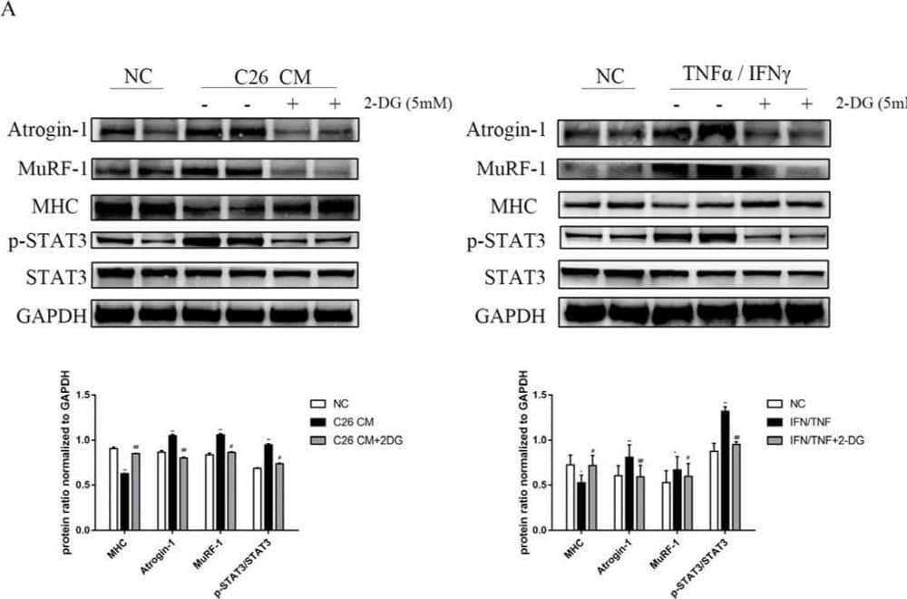 Supplementation with 2-DG reduces cachexic muscle atrophy by blocking USP and ALP pathway activation in C26 conditioned medium-treated C2C12 myotubes. (A) Western blot analysis was used to evaluate atrogin-1, MuRF-1, MHC, p-STAT3, and STAT3 expression in three groups between two cachexia cell lines models. (B) Myosin heavy-chain (MHC) expression in the cell model was evaluated by immunofluorescence staining. Scale bar: 50 µM. MHC, green; Hoechst, blue. The bar graph shows the mean gray value of different groups. (C) Western blot analysis was used to evaluate atrogin-1, MuRF-1, p-STAT3, STAT3, p62, LC3, cleaved PARP, and cleaved caspase3 expression in the cell model of the four groups. Cells were treated with 5 mM 2-DG, 20 µM cisplatin, or 25 µM chloroquine for 24 h. (D) LC3 expression in the cell model was evaluated by immunofluorescence staining. Scale bar: 50 µM. LC3, green; Hoechst, blue. The bar graph shows the mean gray value of different groups. Data are expressed as the mean ± SD, * p < 0.05, ** p < 0.01 compared with NC groups; # p < 0.05, ## p < 0.01 compared with C26 CM group or TNF alpha /IFN gamma  group, n = 10. Image collected and cropped by CiteAb from the following open publication (//pubmed.ncbi.nlm.nih.gov/36230949), licensed under a CC-BY license. Not internally tested by R&D Systems.