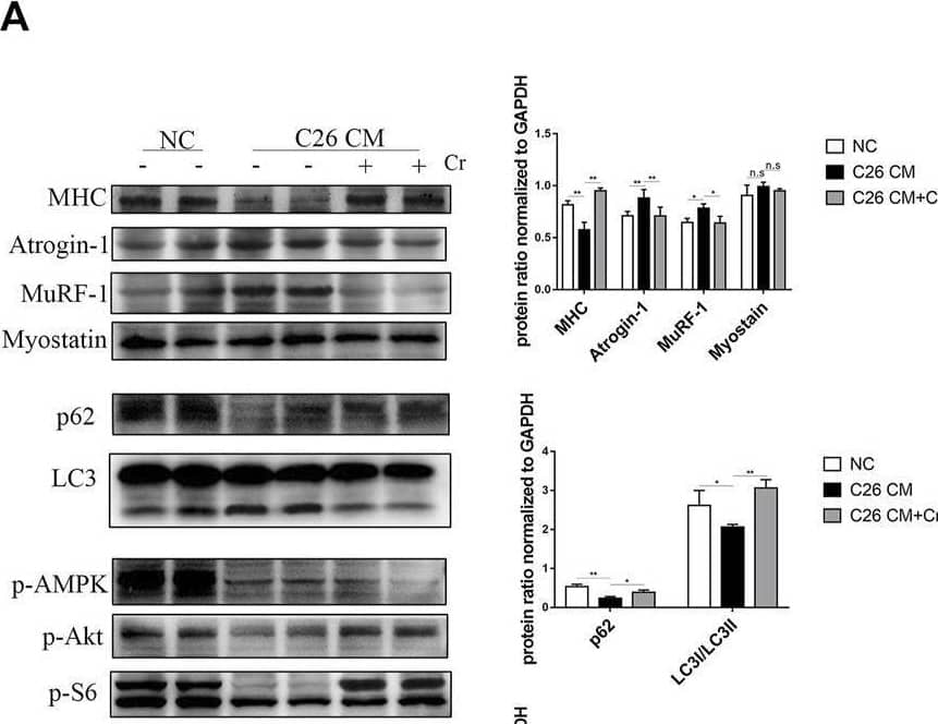Supplementation with creatine prevents myotubular atrophy by inhibiting the activation of UPS and ALS. (A) Western blot analysis was performed to evaluate the expression of MHC, Atrogin-1, MuRF-1, Myostatin, p62, LC3, p-AMPK, p-Akt, p-S6 and p-4EBP1 in the NC group, cachexia group and cachexia + Cr group (mean ± SD, n = 6). *p < 0.05, **p < 0.01, ***p < 0.001. (B) Myosin heavy chain (MHC) expression in the cell model was evaluated by IF staining. MHC, green, DAPI, blue. The bar graph shows the mean gray value of different groups. (C) LC3 expression in the cell model was evaluated by IF staining. LC3, green, DAPI, blue. The bar graph shows the mean gray value of different groups. Data are expressed as the mean ± SD, **p < 0.01. Image collected and cropped by CiteAb from the following open publication (//pubmed.ncbi.nlm.nih.gov/36569317), licensed under a CC-BY license. Not internally tested by R&D Systems.