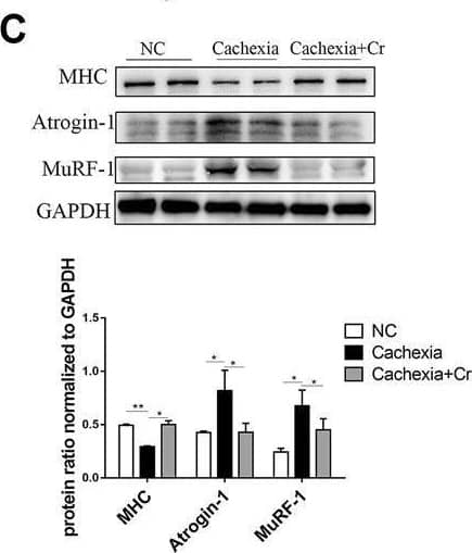 Supplementation with creatine inhibits UPS and ALS activation, thereby preventing skeletal muscle atrophy. (A) Representative HE staining showing the morphological changes in the muscles of the three groups. Average size of muscle fiber cross-sectional area in the NC mice, cachectic mice, or creatine-treated cachectic mice. Representative Masson’s trichrome staining of paraffin sections from muscle fibers of different groups of mice is shown. The bar graph shows the collagen volume fraction (CVF) measured by ImageJ. The glycogen content was determined by Periodic Acid-Schiff (PAS) staining. The histogram shows the optical density (OD) of PAS staining. (B) Gastrocnemius myosin heavy chain (MHC) expression was evaluated by immunofluorescence (IF) staining. The bar graph shows the mean gray value of different groups. Gastrocnemius sections were stained with an antibody against laminin and DAPI. The bar graph shows the mean gray value of different groups. (C) Western blot analysis was used to evaluate MHC, Atrogin-1 and MuRF-1 expression in the three groups (mean ± SD, n = 6). *p < 0.05, **p < 0.01. (D). Western blot analysis was used to evaluate p62 and LC3 expression in the three groups (mean ± SD, n = 6). *p < 0.05, **p < 0.01. (E) Western blot analysis was used to evaluate iNOS, p-Akt, p-AMPK, p-mTOR, p-4EBP1, p-S6 and p-STAT3 in the three groups (mean ± SD, n = 6). *p < 0.05, **p < 0.01. Data are expressed as the mean ± SD. Image collected and cropped by CiteAb from the following open publication (//pubmed.ncbi.nlm.nih.gov/36569317), licensed under a CC-BY license. Not internally tested by R&D Systems.