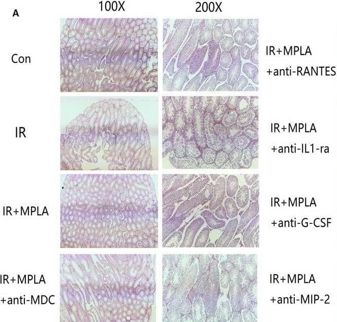 Immunohistochemistry CXCL2/GRO beta/MIP-2/CINC-3 Antibody (40605) [Unconjugated]
