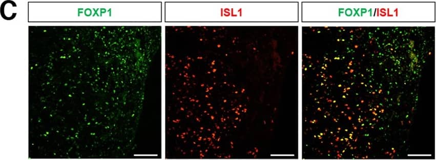 Spinal organoids consists of various spinal cord cell types.Representative images illustrating the presence of a HOXB4+ and b HOXC8+ cells in spinal organoids. Cellular nuclei were counterstained with DAPI. Scale bars, 100 μm. c Co-staining of FOXP1 (green) and ISL1 (red) demonstrates presence of limb-innervating neurons in spinal organoids. Scale bars, 100 μm. d Representative images of spinal organoids at day 42 stained with ISL1 (red) and ChAT (green). Cellular nuclei were counterstained with DAPI. Scale bars, 100 μm. Spinal organoids are stained with e CHX10+ cells (RED) and f CALB+ cells (green). Scale bars, 100 μm. g Co-staining of S100 beta  and TUJ1 shows presence of astrocytes in spinal organoids. Scale bars, 100 μm. h Quantitative-PCR analysis demonstrates a lack of dorsal cell types in the spinal organoids generated Image collected and cropped by CiteAb from the following publication (//pubmed.ncbi.nlm.nih.gov/30368521), licensed under a CC-BY license. Not internally tested by R&D Systems.